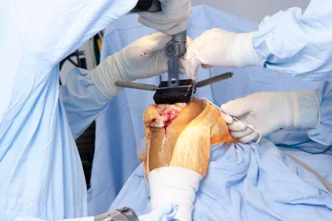 Operation Stock Photos