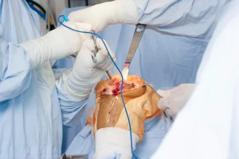 Operation Foto stock