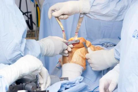 Operation Stock Photos