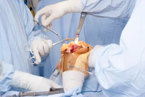 Operation 스톡 사진