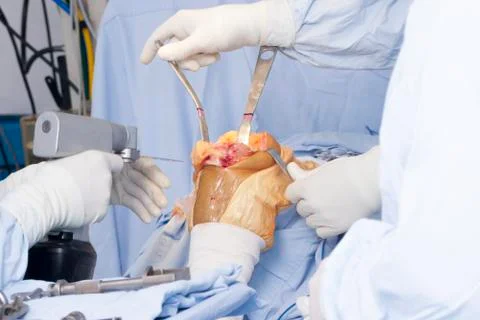 Operation Stock Photos