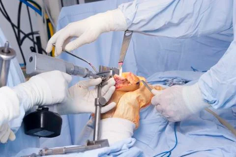 Operation Stock Photos