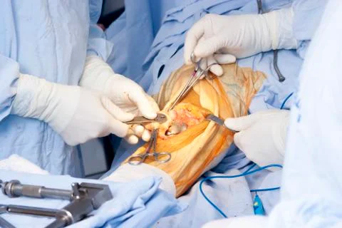 Operation Stock Photos