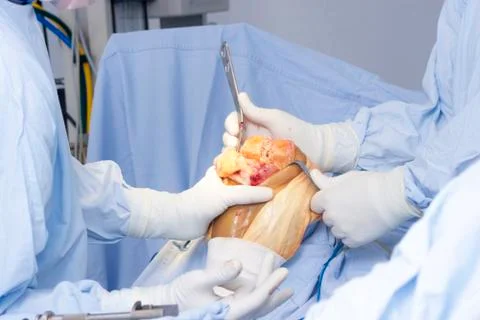 Operation Stock Photos