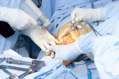 Operation Stock Photos