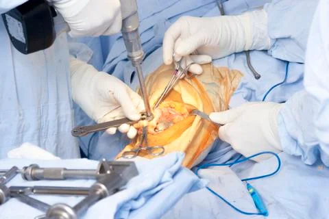 Operation Stock Photos