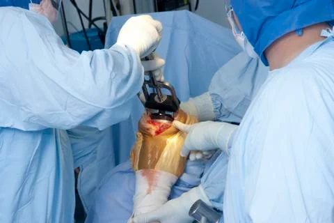 Operation Stock Photos