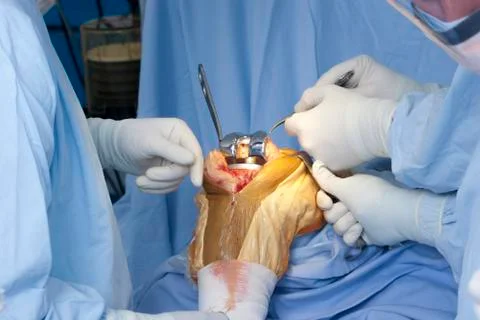 Operation Stock Photos