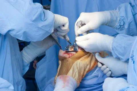 Operation Stock Photos