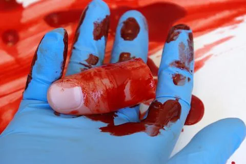 Operation Severed Thumb Stock Photos