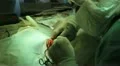 Operation. Surgical table. implantation Vidéos HD
