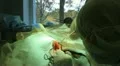 Operation. Surgical table. implantation Vidéos HD