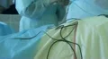 Operation. Surgical table. implantation Vidéos HD