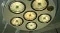 Operation. Surgical table. implantation Vidéos HD