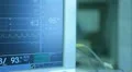 Operation. Surgical table. implantation Vídeos en HD