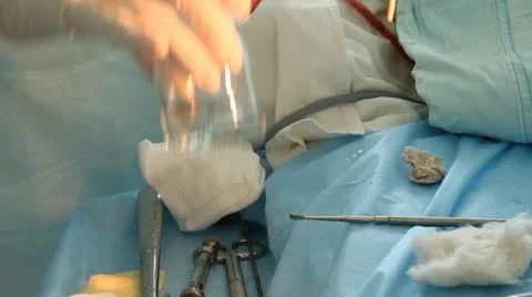 Operation. Surgical table. implantation Stock Footage