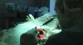 Operation. Surgical table. implantation Photo
