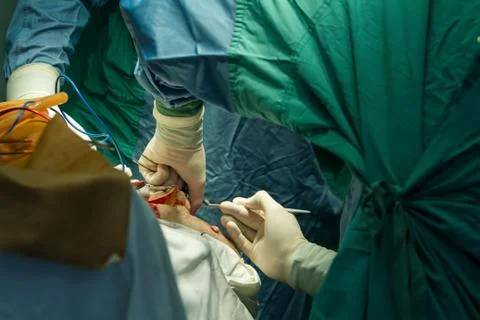 Operation of trepanation of the skull. Stock Photos