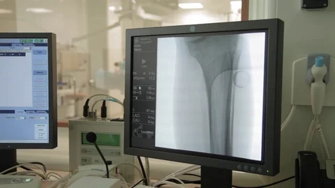 Operation under x-ray control Stock Footage 81321972