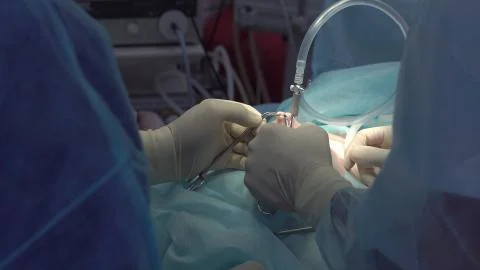 Operation using laparoscopic equipment. Surgeons team. Hospital. Stock Photos
