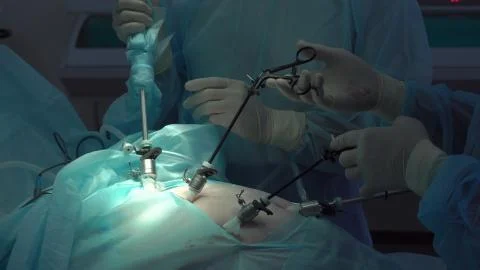 Operation using laparoscopic equipment. Surgeons team. Hospital. Stock Photos