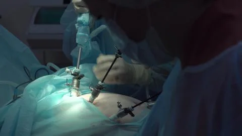 Operation using laparoscopic equipment. Surgeons team. Hospital. Stock Photos