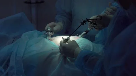 Operation using laparoscopic equipment. Surgeons team. Hospital. Stock Photos