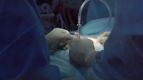 Operation using laparoscopic equipment. Surgeons team. Hospital. Stock Photos