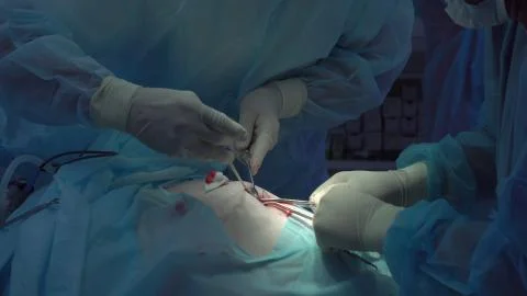 Operation using laparoscopic equipment. Surgeons team. Hospital. Stock Photos