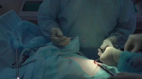 Operation using laparoscopic equipment. Surgeons team. Hospital. Stock Photos