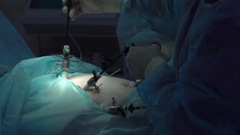 Operation using laparoscopic equipment. Surgeons team. Hospital. Stock Photos