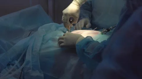 Operation using laparoscopic equipment. Surgeons team. Hospital. Stock Photos