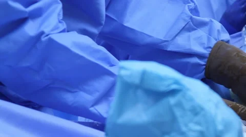 Operation: Vein Vasular Surgery Stock Footage 41240359