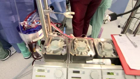 The operation of the ventilator piston, against the background of a doctor Stock Footage 144554584