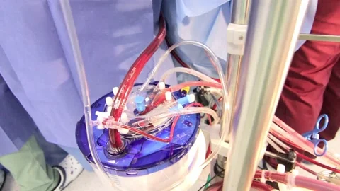 The operation of the ventilator piston, against the background of a doctor Stock Footage 144565180