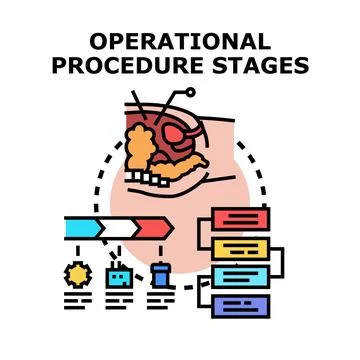 Operational procedure stages vector illustration concept Stock Illustration