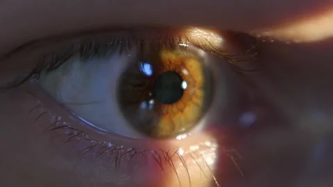 Ophthalmic examination of eye in clinic using slit lamp. Close-up of ophthalmic Stock Footage 154166752