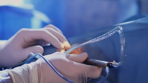An ophthalmic surgery specialist performs an operation Stockbeeldmateriaal 265012177
