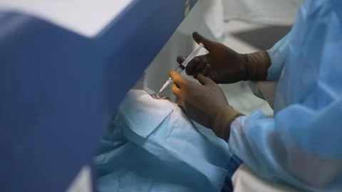 Ophthalmologist Performing Eye Surgery Stock Footage 331719630