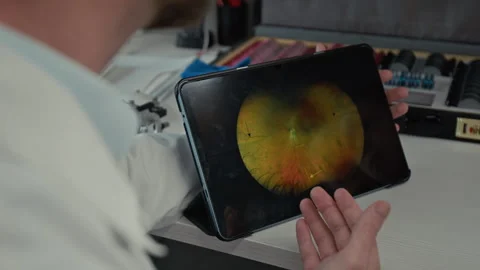 Ophthalmologist Pointing at Tablet Screen with Eye Images Stock Footage 322692812