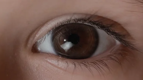 Optic  brown eye. The iris of the human eye is narrowed. Stock Footage 239475128