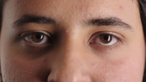 Optometry, face and eyes with assessment, optical test or glaucoma screening in Stock Footage 336674839