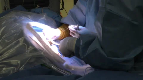 OR surgeons suture incision after surgery closeup of hands Stock Footage 147097526