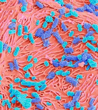 Oral bacteria, SEM Foto stock