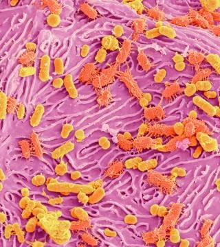 Oral bacteria, SEM Foto stock