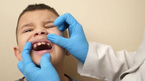 The oral cavity of a boy with missing teeth is examined Stock Footage 263700655