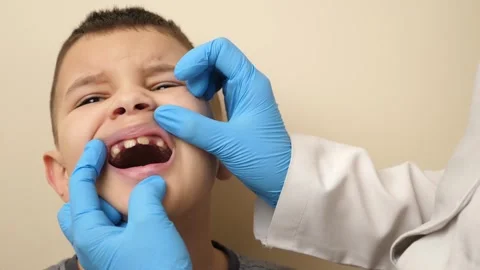 The oral cavity of a boy with missing teeth is examined. Slow motion. Stock Footage 263873670