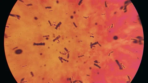 Orange Dna Soup under a microscope Stock Footage 234340672
