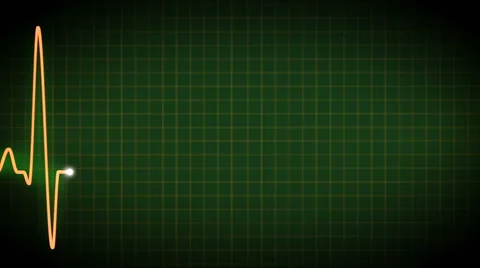 Orange ECG graph Stock Footage 48761715