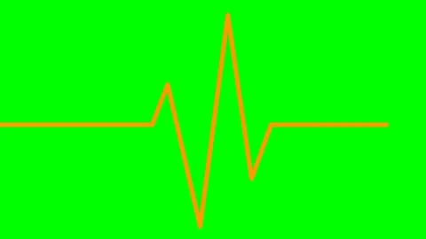 Orange line cardiogram green Stock Footage 236896343